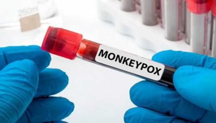 Madhya Pradesh: Public Health Department issued advisory regarding monkey pox, instructions for control and prevention