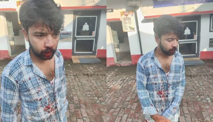 A poor dairy youth was attacked in Rampur due to a minor dispute, his condition is critical