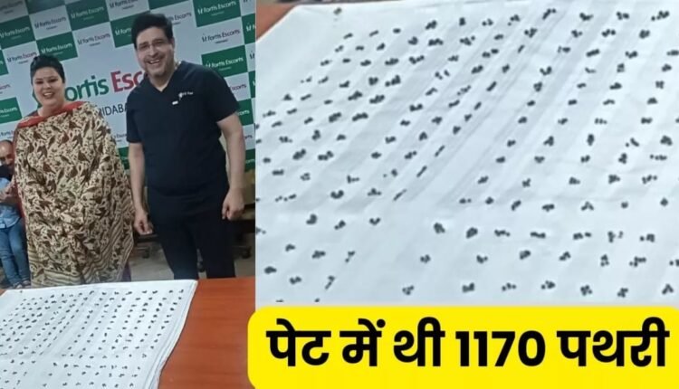 1170 stones were removed from the woman's stomach, please keep these things in mind; otherwise your life can be in danger