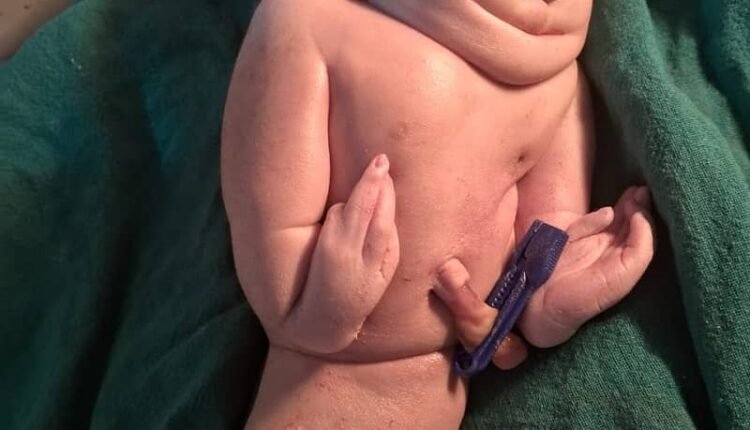 A woman gave birth to a miraculous child in Max Hospital