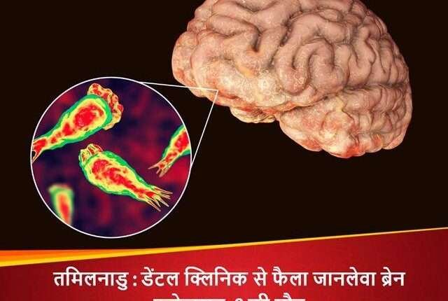 Deadly brain infection spreads from dental clinic in Tamil Nadu, 8 dead