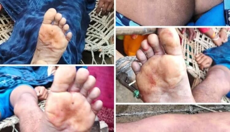 Teen dies due to police's third degree, Etah police raises question of justice