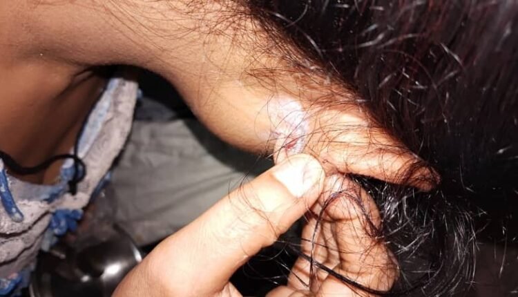 In Mirzapur, masked bike riders snatched the earring from the ear of a woman riding a scooter and fled