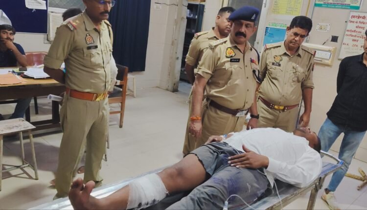 Police did a half encounter with the accused of raping a minor, shot him in the leg